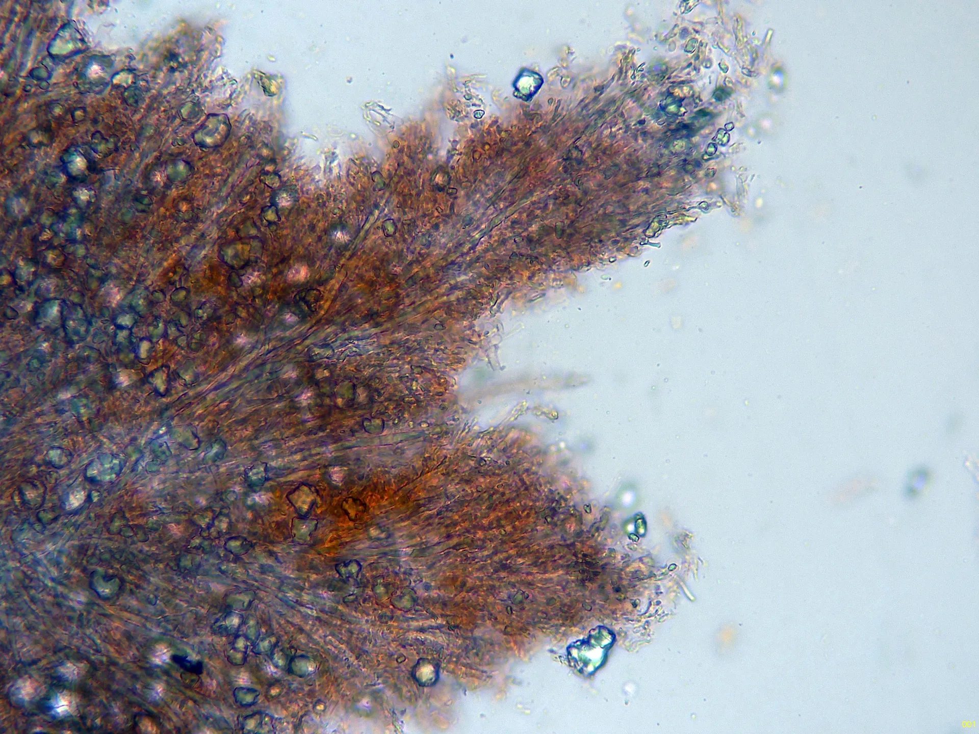 Microscopía de Mycoacia aurea - 4 - Acúleo x 400-001